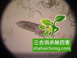 螨虫对人体有哪些危害控虫公司告诉你
